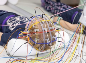 Neue Diagnostik für kleine Patienten: Gemeinsam für ein EEG-System