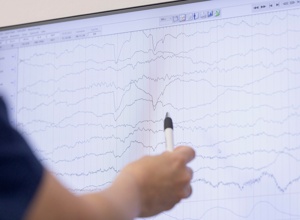 Neue Diagnostik für kleine Patienten: Gemeinsam für ein EEG-System
