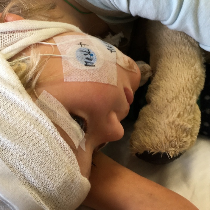 EEG für SYNGAP1-Kinder