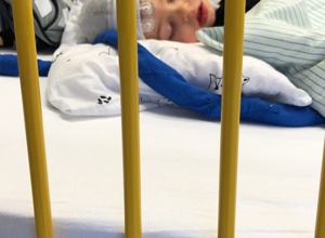EEG für SYNGAP1-Kinder