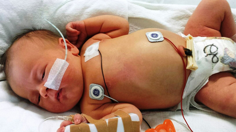 Babys und Kinder schonend operieren - mit Ihrer Hilfe: Spenden!