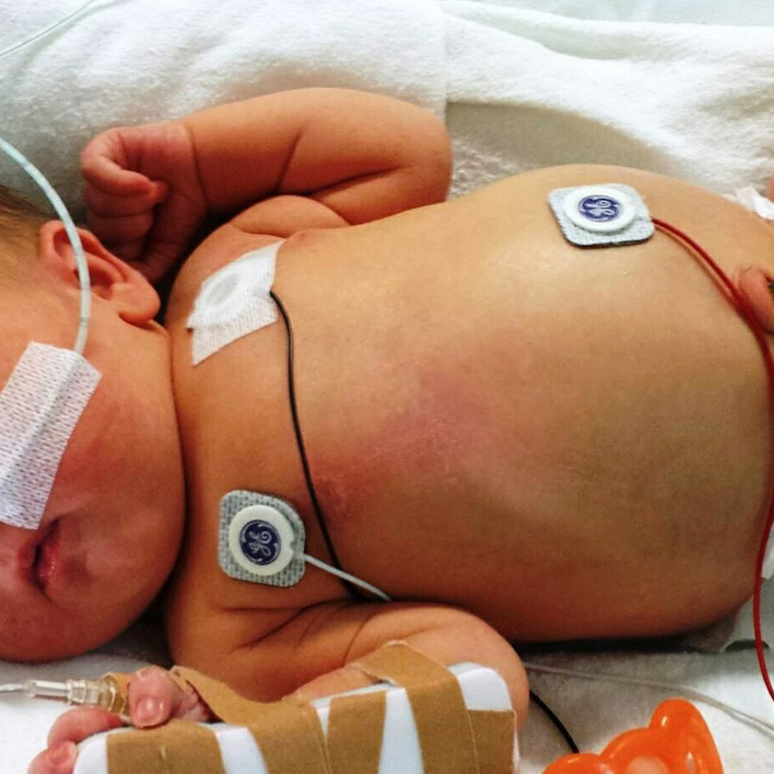 Babys und Kinder schonend operieren - mit Ihrer Hilfe: Spenden!