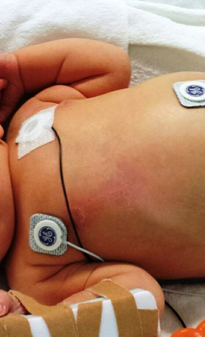Babys und Kinder schonend operieren - mit Ihrer Hilfe: Spenden!